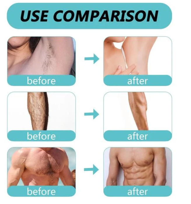 Evvoli Hair Removal Spray