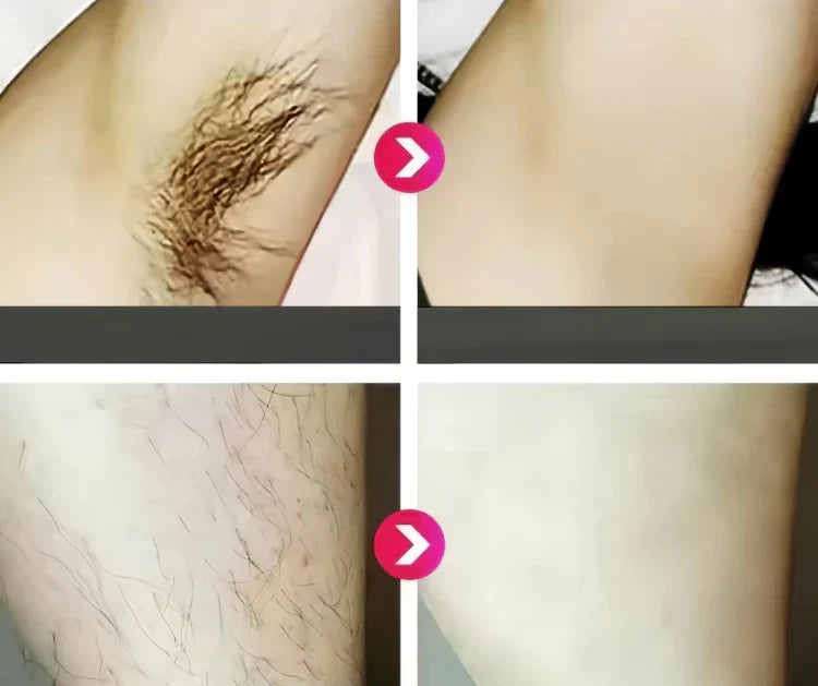 IPL Laser Hair Removal Device                     تقييم الثقة 4.9 | أكثر من 1,756 مراجعة